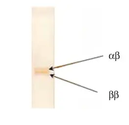 Anti-S100 antibody [6G1] used in Western Blot (WB). GTX10203